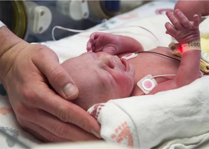 Portal do Médico - Mulher com útero transplantado tem bebê ...